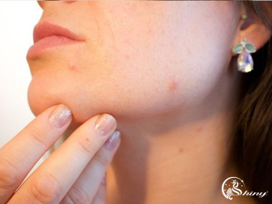 7 thói quen chăm sóc da vào mùa hè, tưởng tốt nhưng rất hại 