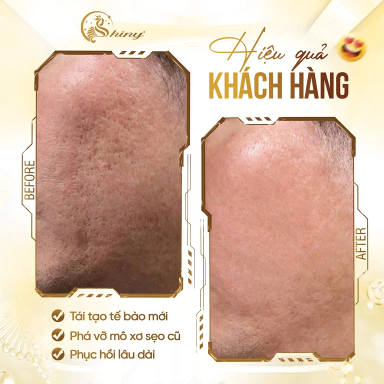 Phản hồi khách hàng sau chăm sóc da tại Shiny Beauty Clinic