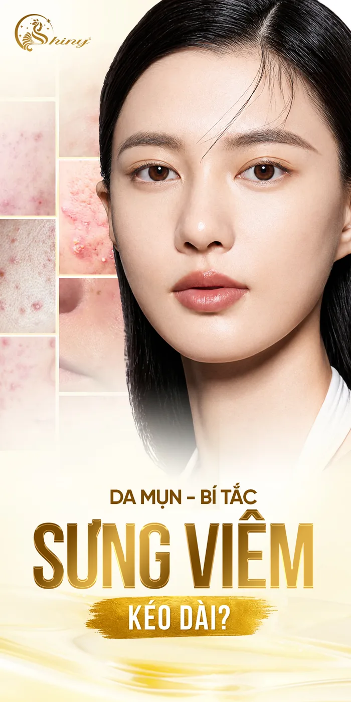 Thiết kế Shiny minh họa khuôn mặt và tình trạng da mụn, bí tắc