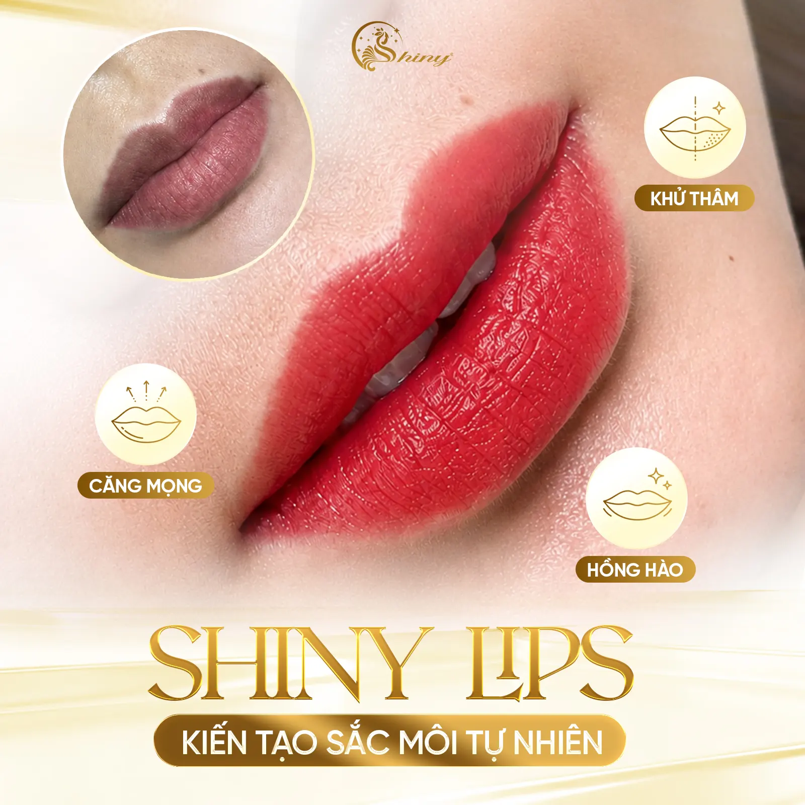 Hình ảnh minh họa sắc độ môi sau phun tại Shiny Beauty Clinic