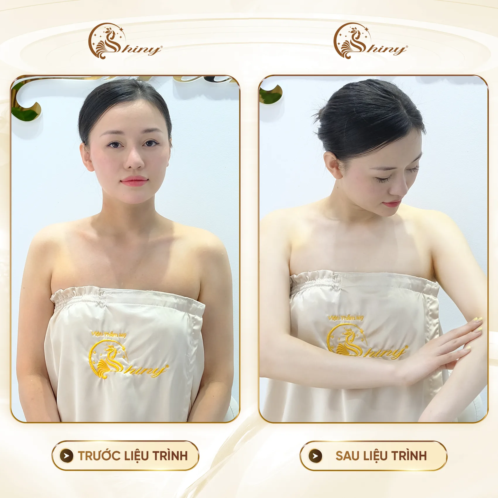 Hình ảnh chăm sóc trắng sáng body tại Shiny Beauty Clinic Đà Nẵng