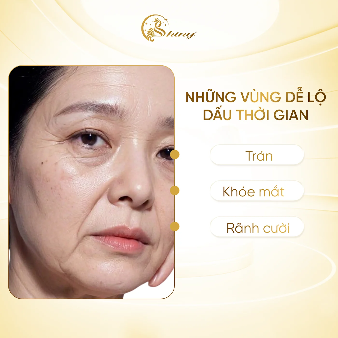 Những vùng dễ lộ dấu thời gian trên gương mặt: trán, khoé mắt, rãnh cười