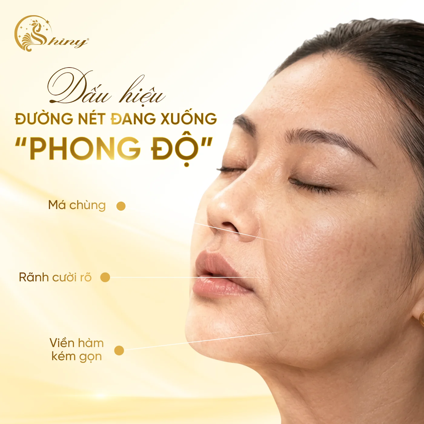 Thiết kế Shiny về dấu hiệu đường nét thay đổi: má chùng, rãnh cười rõ, viền hàm kém gọn