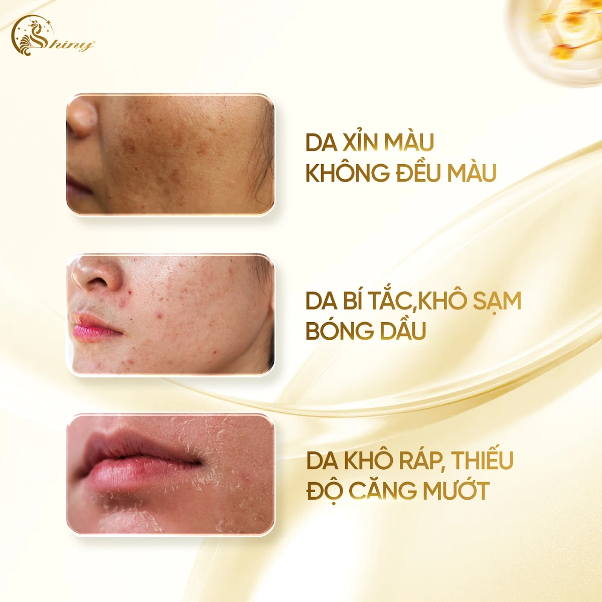 Hình minh hoạ các tình trạng da xỉn màu, bí tắc, khô ráp